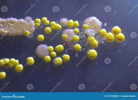 how are yeast colonies similar to bacterial colonies